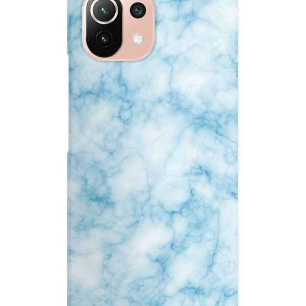 Buy Blue White Natural Marble Snap Case for Xiaomi Mi 11 Lite Ne (5G) at Rs. 99 Only - Zapvi